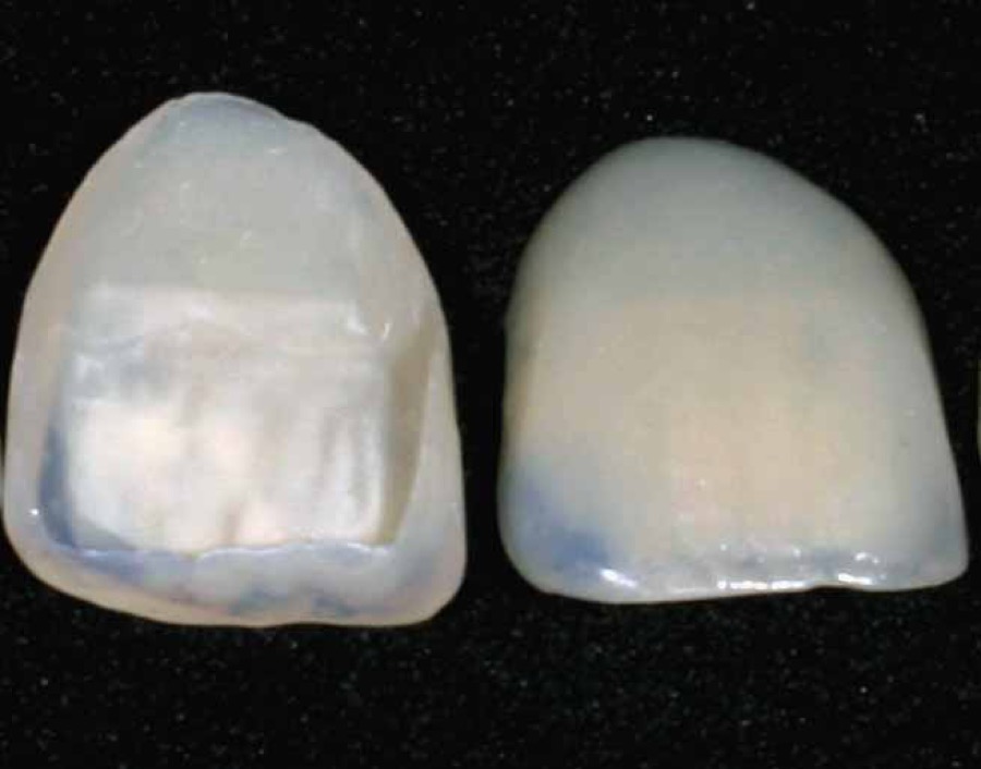 Ästhetische Zahnheilkunde